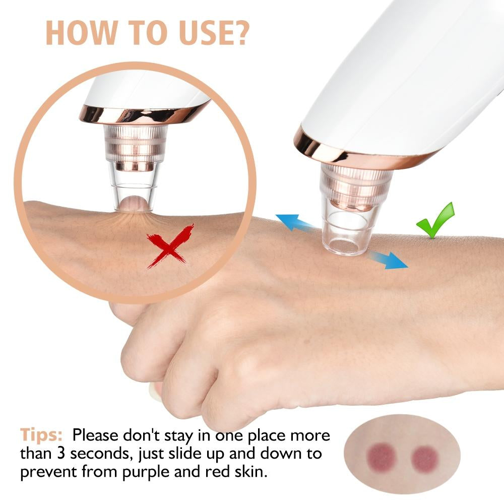 5in1 Rechargeable Blackhead Remover and Vacuum Suction Acne Pore Cleaner